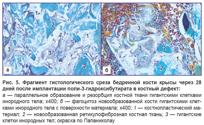 volkov-ris-5.jpg