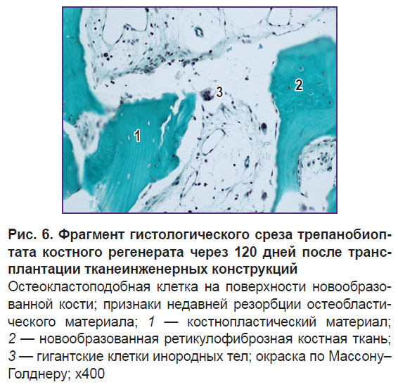 volkov-ris-6.jpg