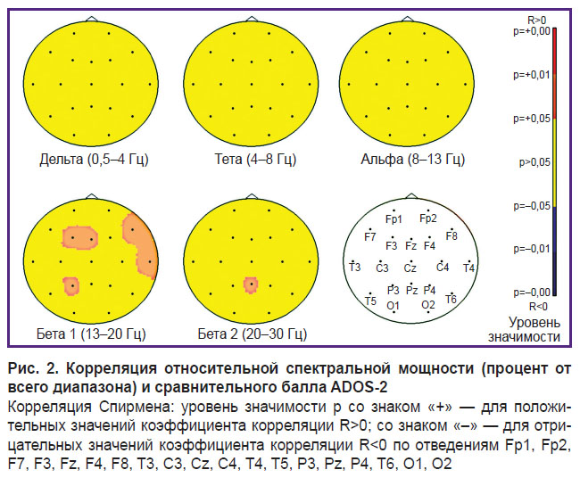 sorokin-ris-2.jpg