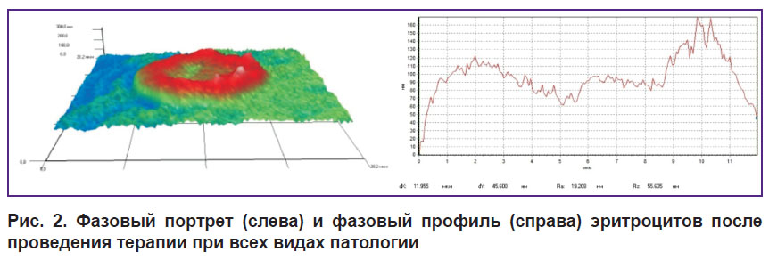 deryugina-ris-2.jpg