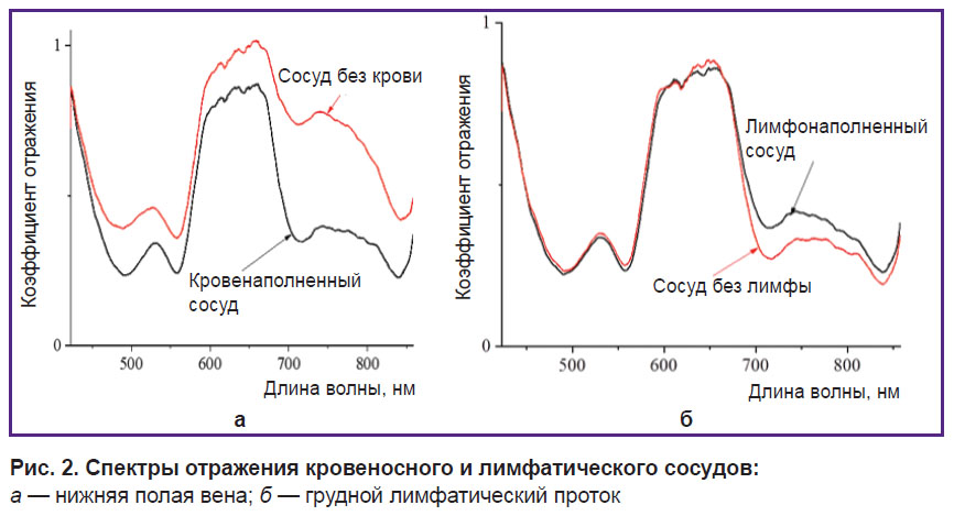 vasilev-ris-2.jpg