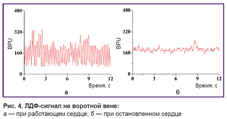 vasilev-ris-4.jpg