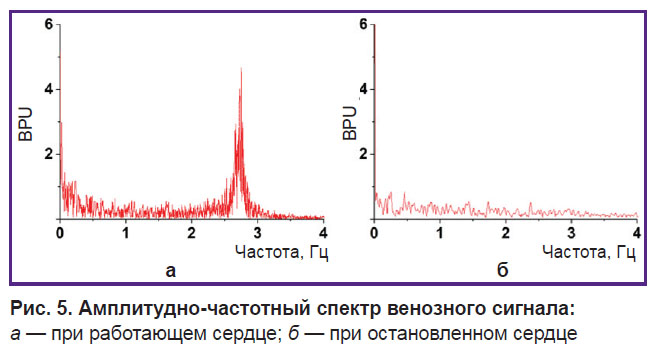 vasilev-ris-5.jpg