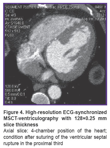 ryazanov-fig-4.jpg