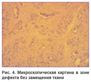 airapetov-ris-4.jpg