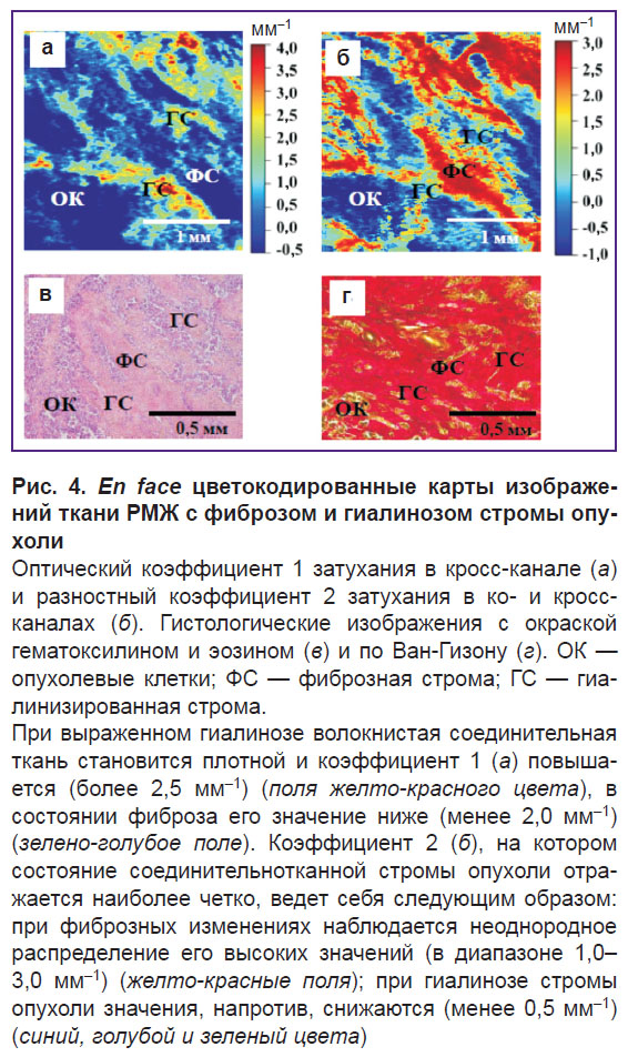 gubarkova-ris-4.jpg