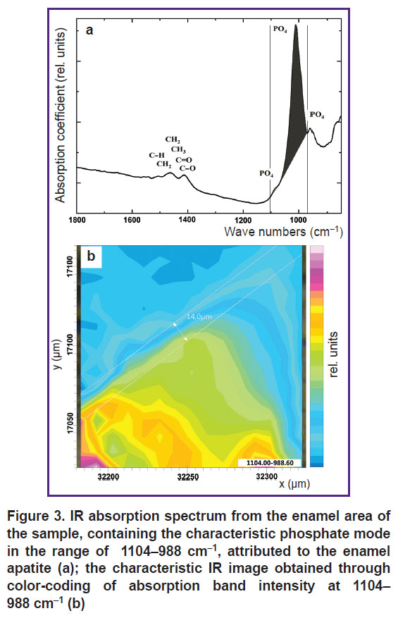 seredin-fig-3.jpg