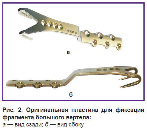 avdeev-ris-2.jpg