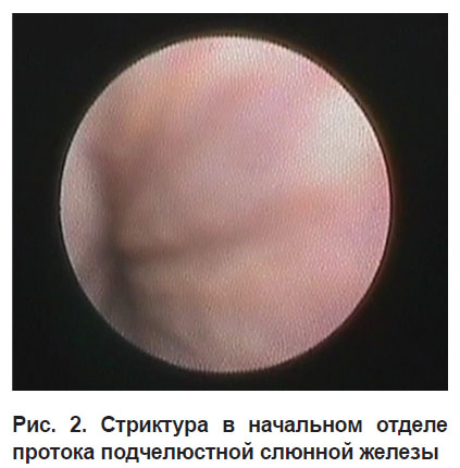 bannikova-ris-2.jpg