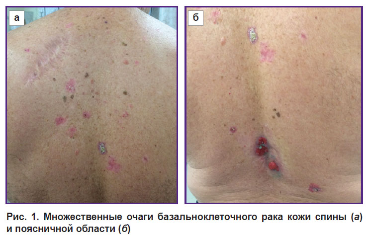 malygina-ris-1.jpg