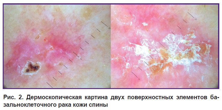 malygina-ris-2.jpg