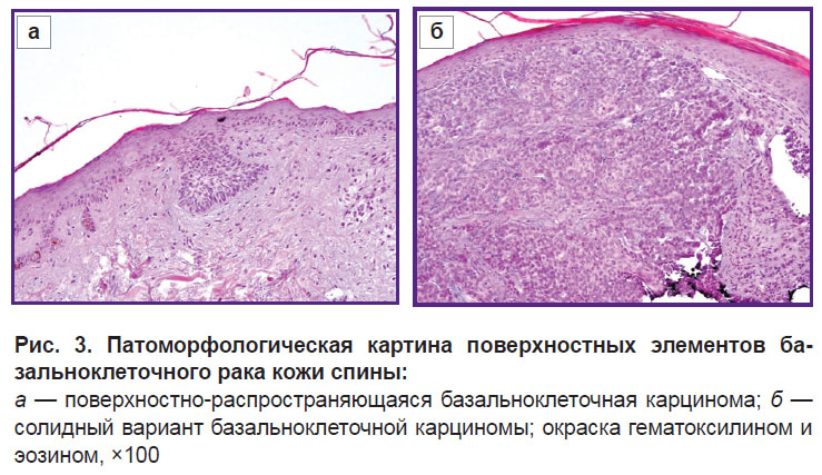malygina-ris-3.jpg