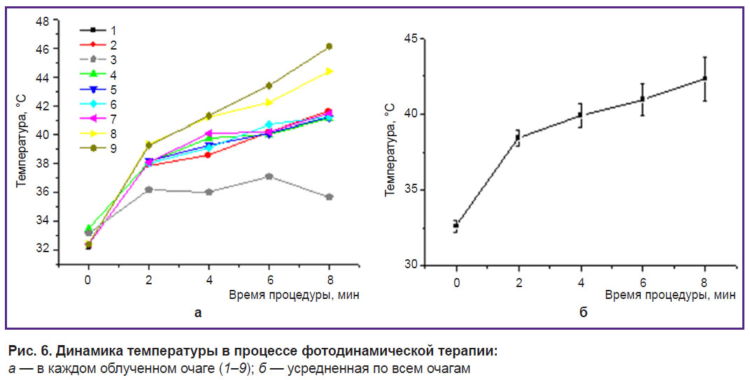 malygina-ris-6.jpg