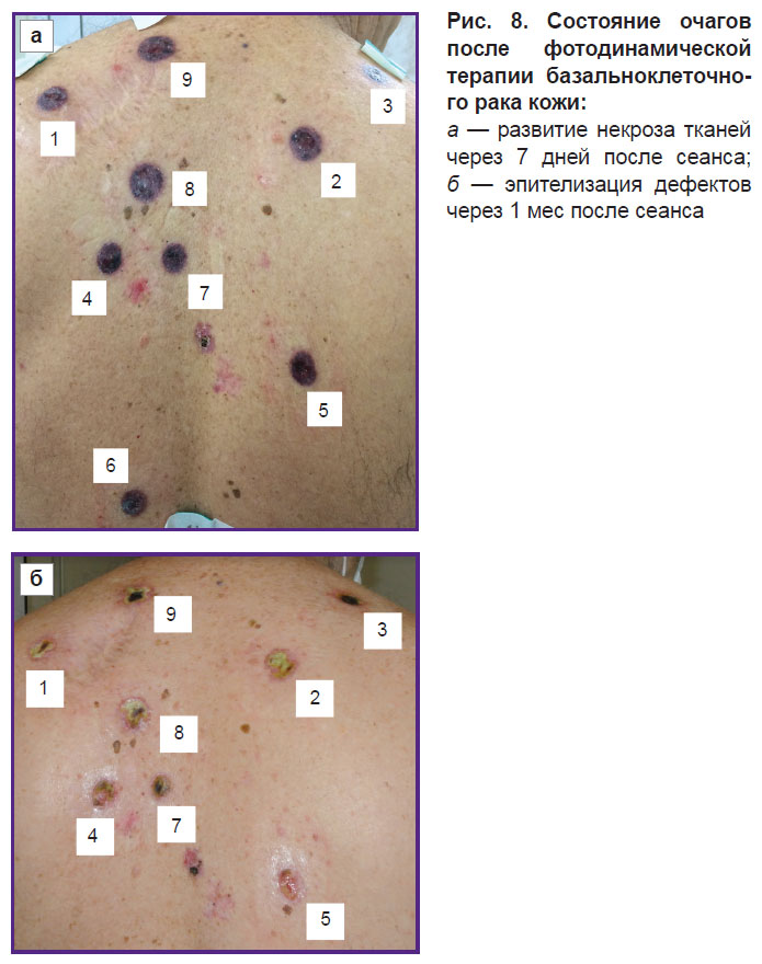 malygina-ris-81.jpg