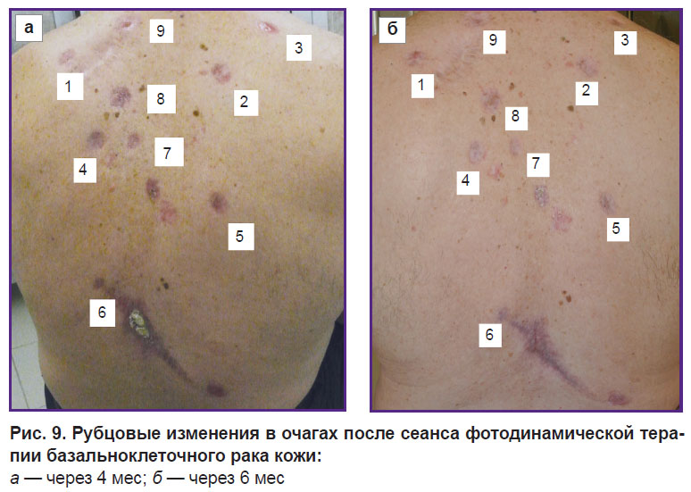 malygina-ris-9.jpg