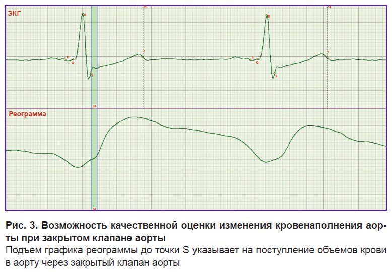 voronova-ris-3.jpg