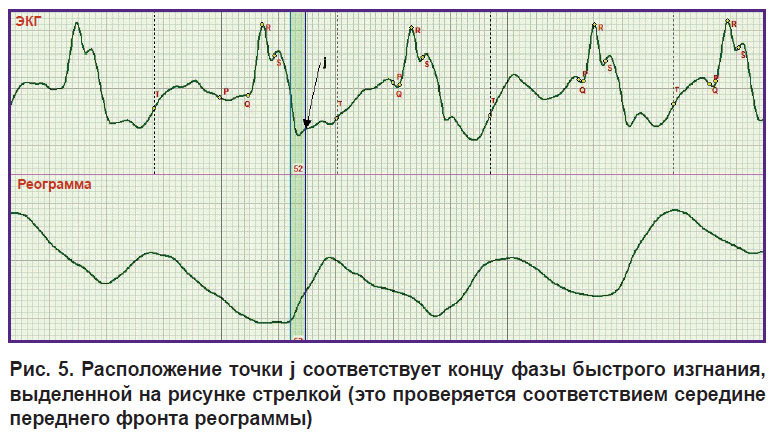 voronova-ris-5.jpg