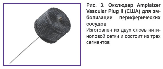dzhagraev-ris-3.jpg