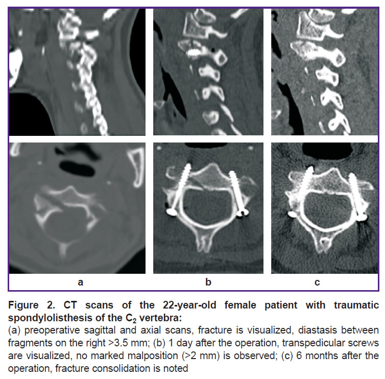 basankin-fig-2.jpg