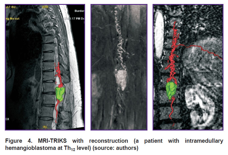 timonin-fig-4.jpg