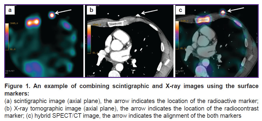 ilyushenkova-fig-1.jpg