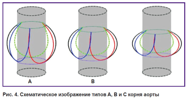 kobelev-ris-4.jpg
