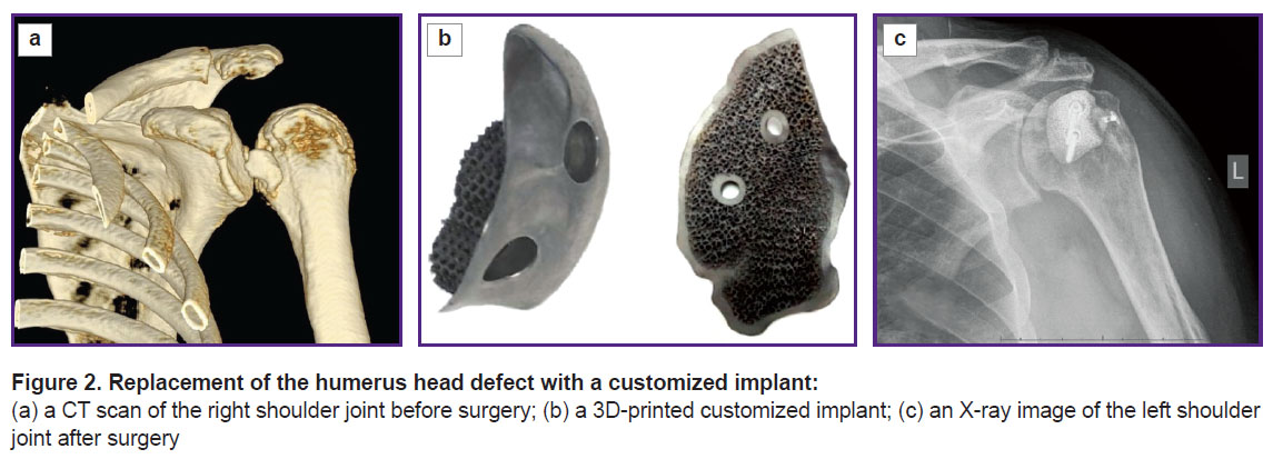 alyev-fig-2.jpg
