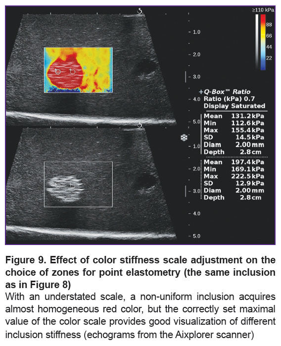 demin-fig-9.jpg
