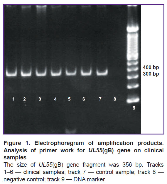vankova-fig-1.jpg