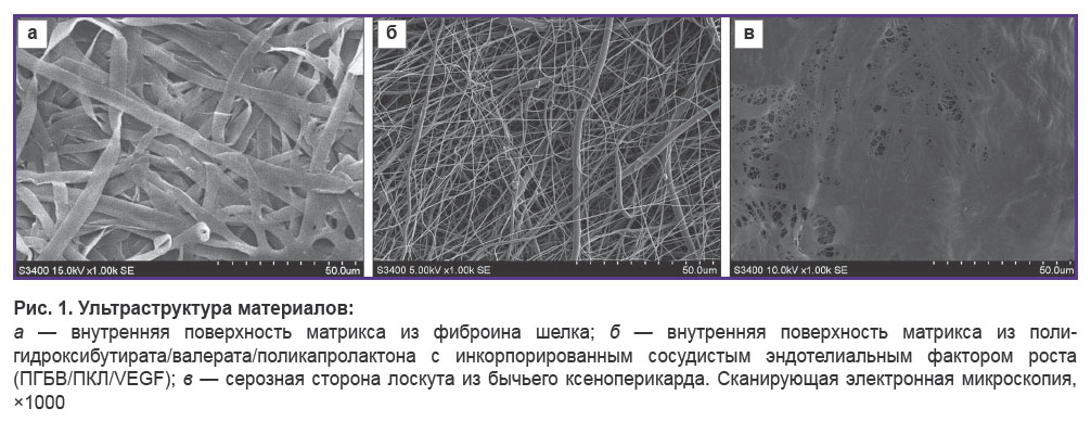 prokudina-ris-1.jpg
