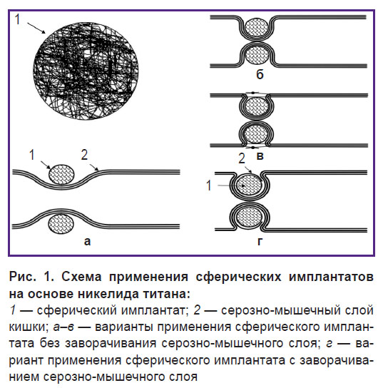 korobeinikova-ris-1.jpg