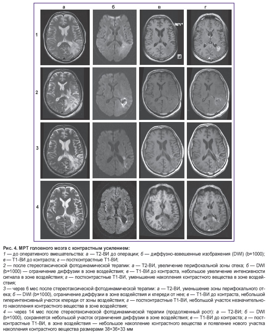 rafaelian-ris-4.jpg
