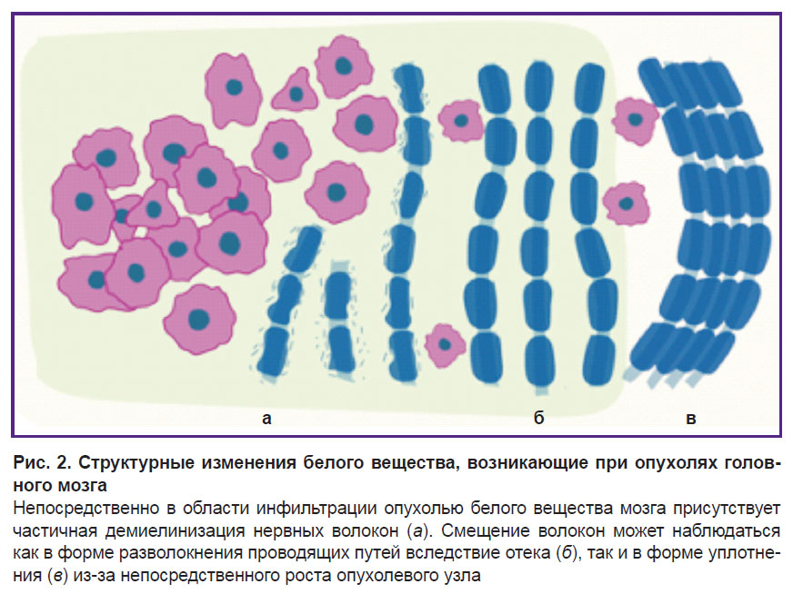 yashin-ris-2.jpg