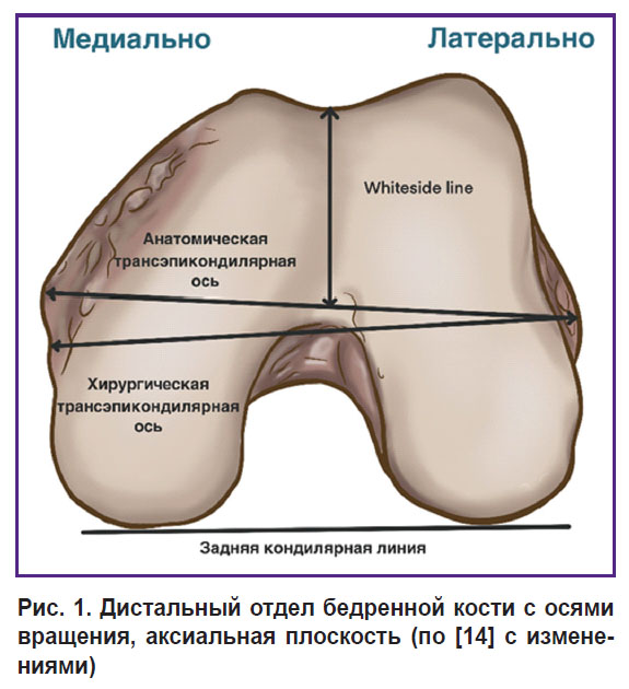 malyshev-ris-1.jpg