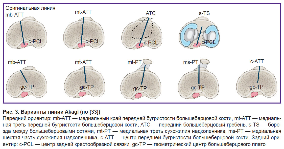 malyshev-ris-3.jpg