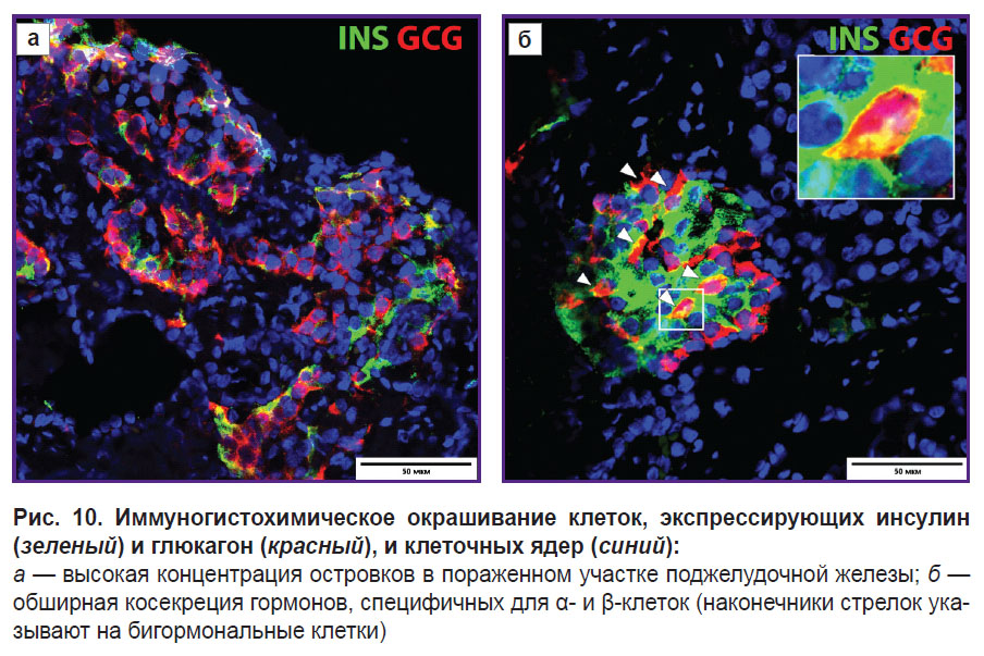 zagainov-ris-10.jpg
