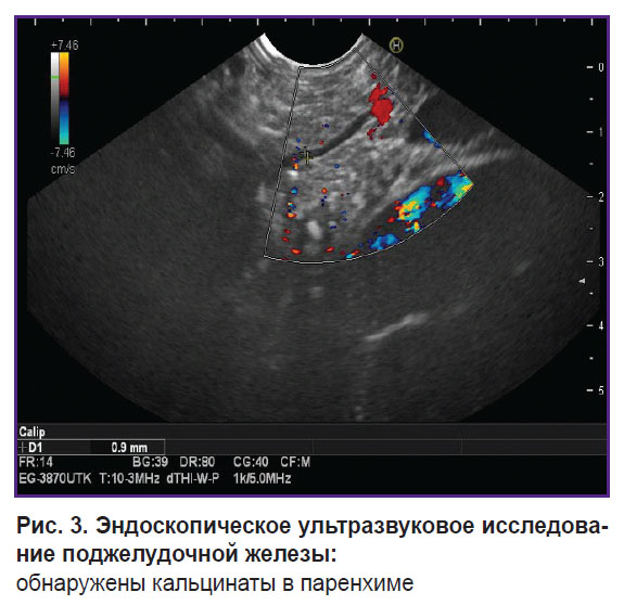 zagainov-ris-3.jpg