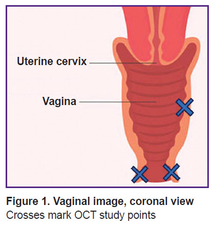 sirotina-fig-1.jpg