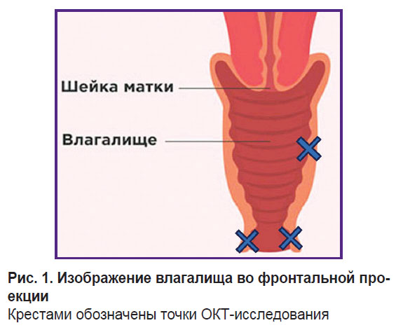 sirotina-ris-1.jpg