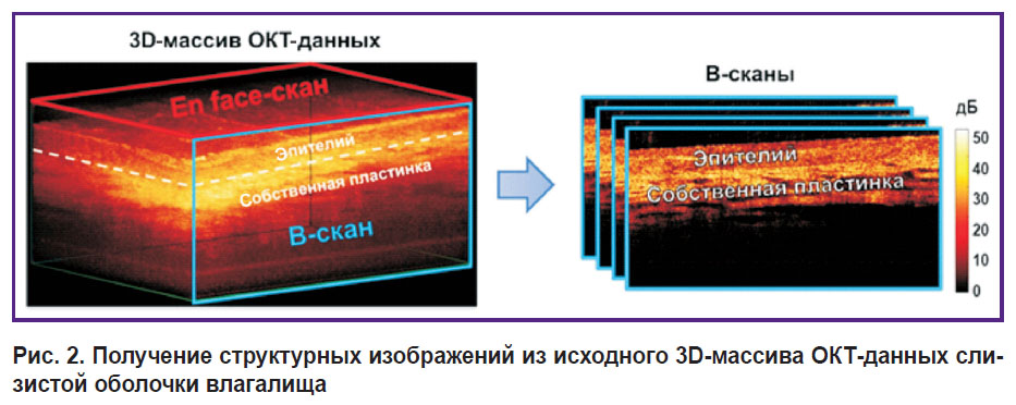 sirotina-ris-2.jpg