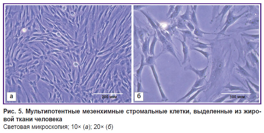 kisel-ris-5.jpg