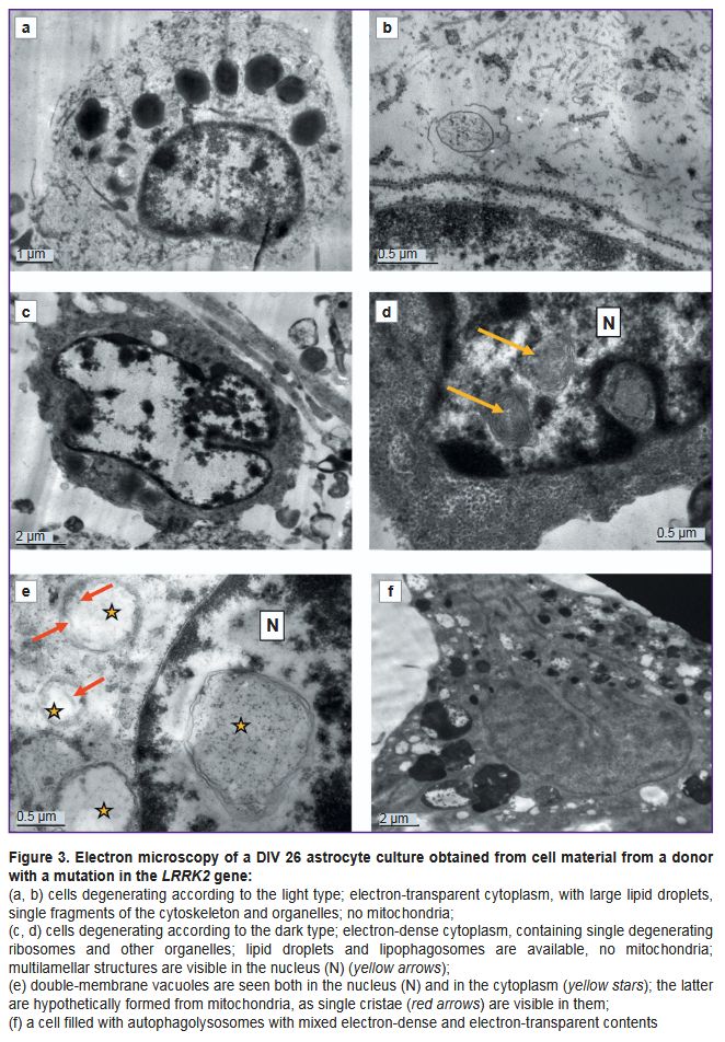 stm-18-1-01-fig-3.jpg