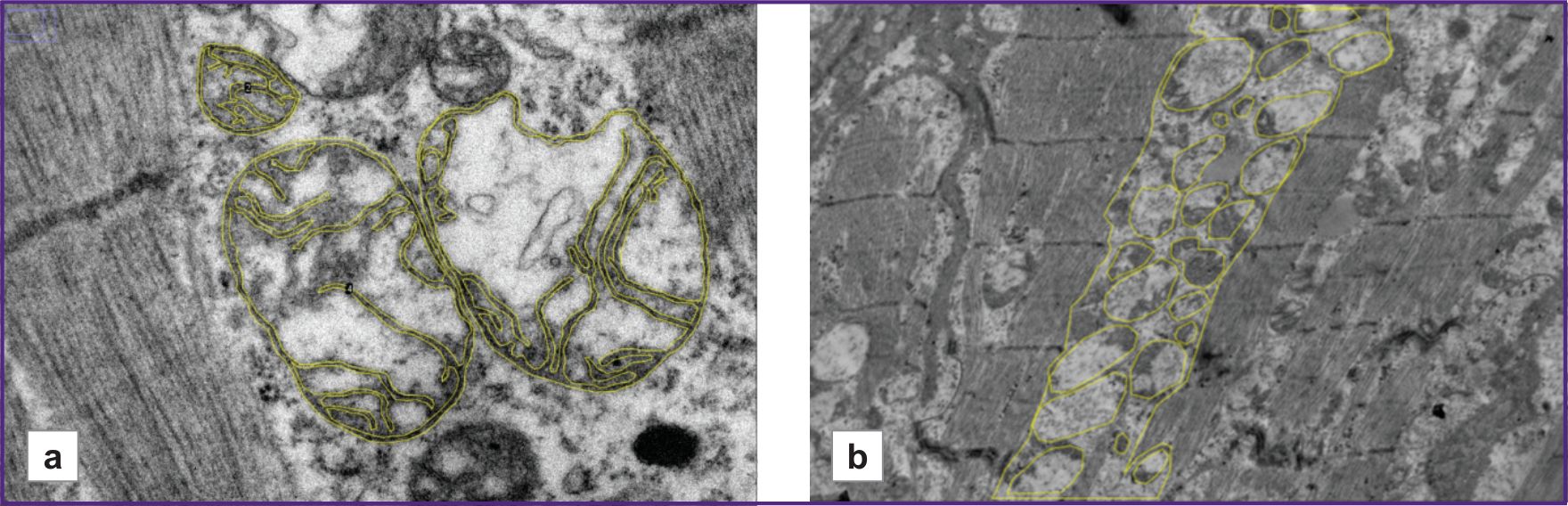 stm-18-2-05-fig-01.jpg